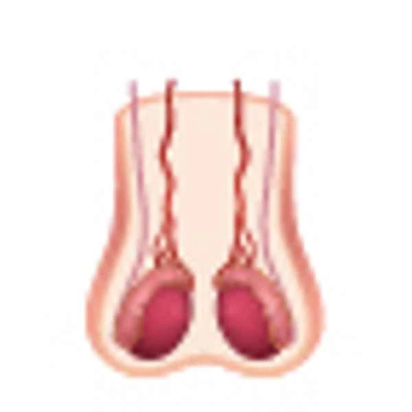 Does scrotal granuloma need to be removed?