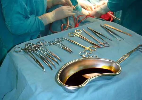 Is scrotal fibroma surgery painful?