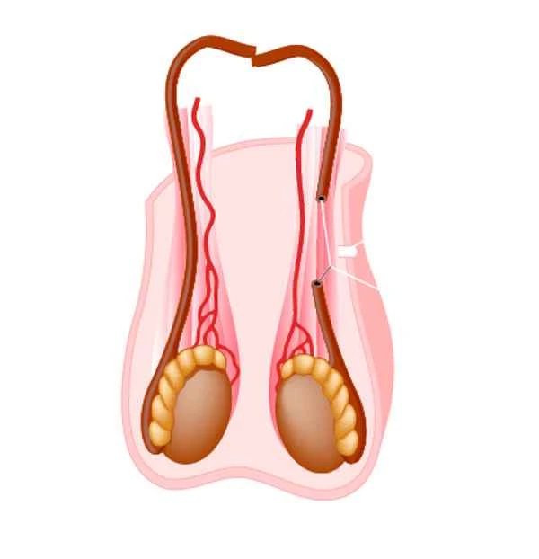 What tests are done for scrotal ptosis?