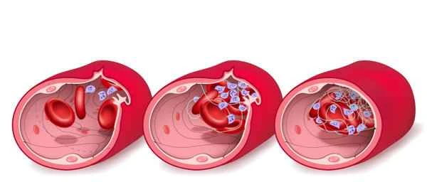 What to do if the scrotal veins are injured?