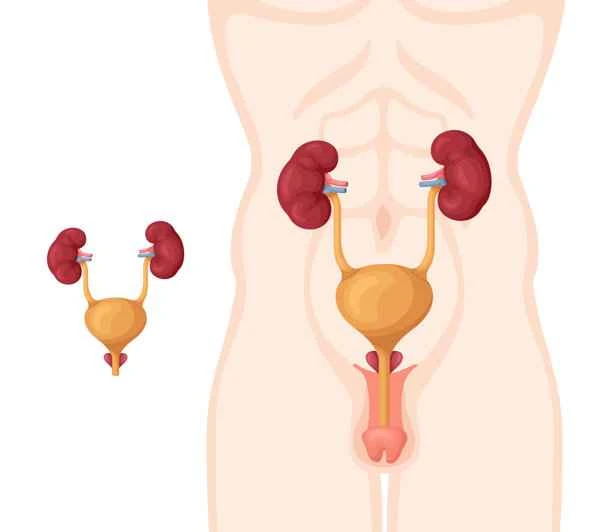 Do Europeans not have prostatitis?