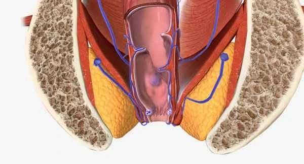 Chronic prostatitis with left scrotal pain