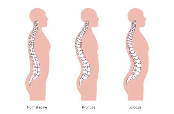 What happens if you try to hold back from ejaculating?