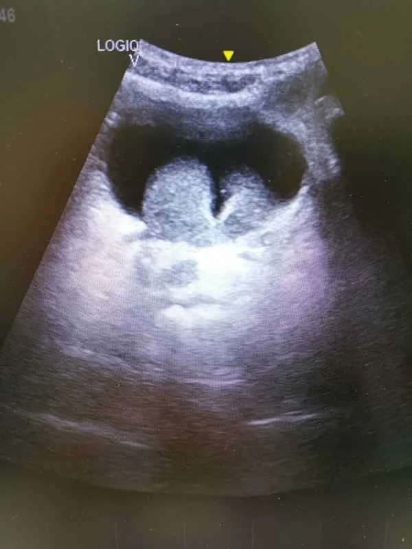 Which department should I go to for a scrotal ultrasound?