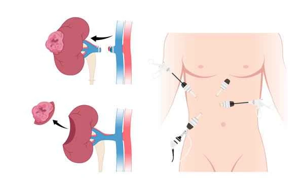 Which department should I go to for a scrotal ultrasound?