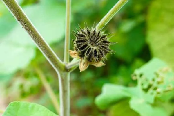 Prostatitis surgery under local anesthesia or general anesthesia