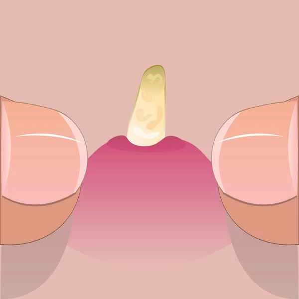 What causes scrotal hot flashes?