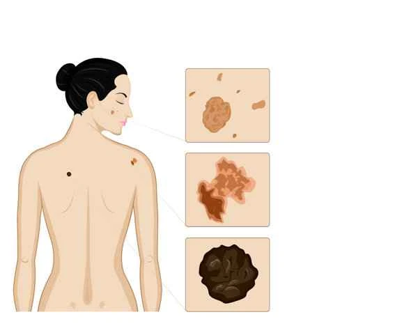 Why does the scrotum feel hot and damp?